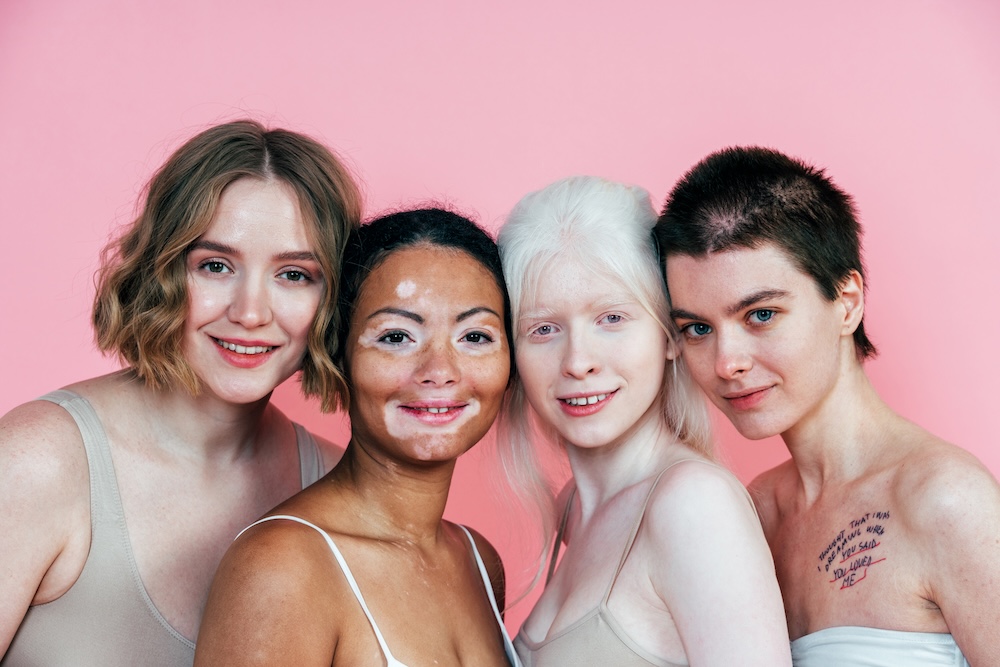 different women with different skin color and personality