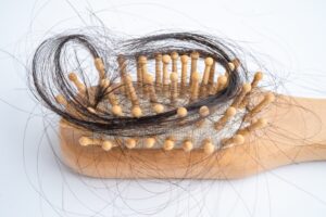 hair loss on a hair brush